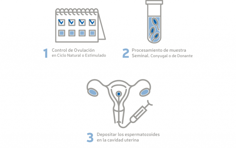 Diferencias Entre Inseminación Artificial Y Fecundación In Vitro 3731