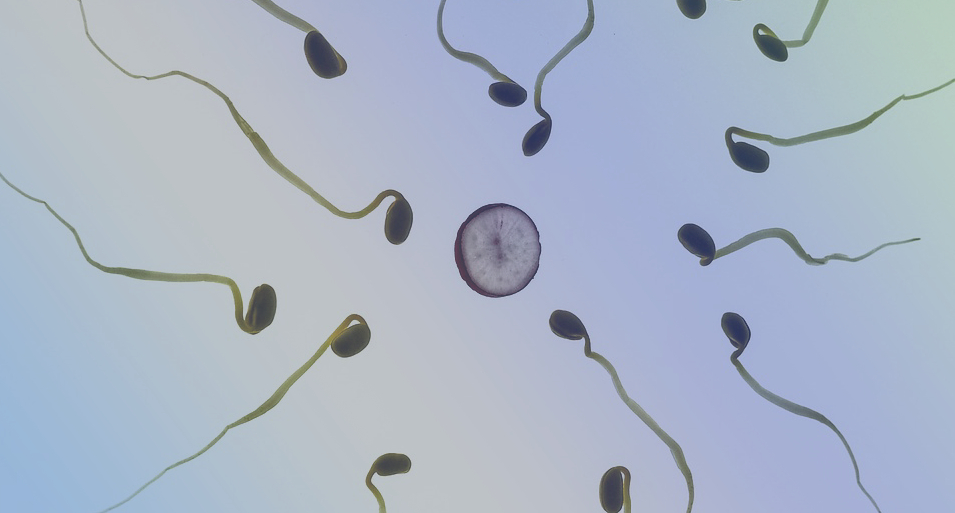 teratozoospermia